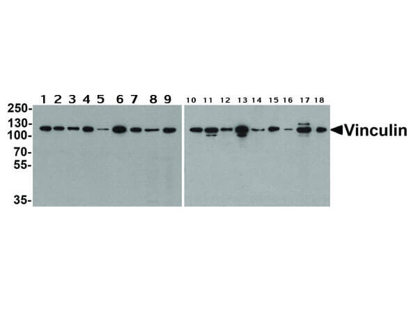 Vinculin Antibody in Western Blot (WB)