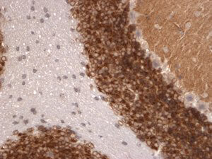 Kv4.2 K+ channel Antibody in Immunohistochemistry (IHC)