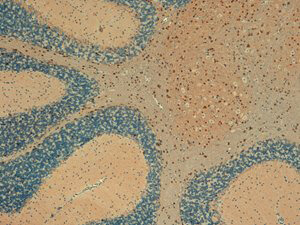 mSlo maxi-K+ channel Antibody in Immunohistochemistry (IHC)