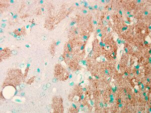 NAV1.7 Antibody in Immunohistochemistry (Paraffin) (IHC (P))