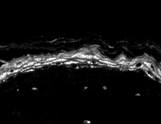 Nav1.8 Antibody in Immunohistochemistry (Paraffin) (IHC (P))