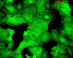 PSD95 Antibody in Immunocytochemistry (ICC/IF)