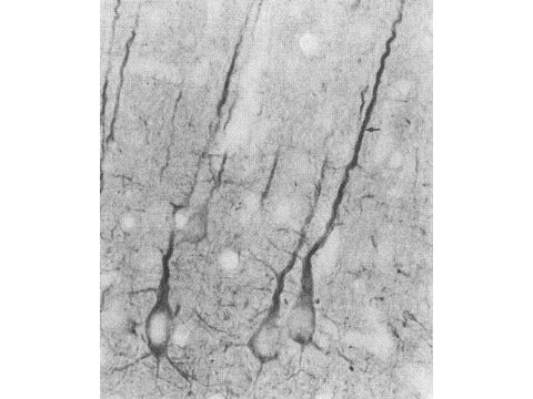 PSD95 Antibody in Immunocytochemistry (ICC/IF)