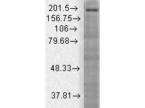SHANK3 Antibody in Western Blot (WB)