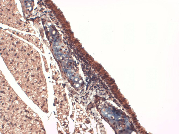 Sodium-Iodide Symporter Antibody in Immunohistochemistry (Paraffin) (IHC (P))