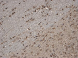 TrpC5 Antibody in Immunohistochemistry (Paraffin) (IHC (P))