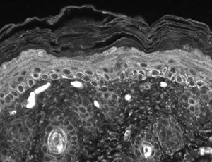 TRPC7 Antibody in Immunohistochemistry (Paraffin) (IHC (P))