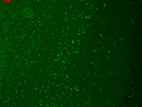 Trpm7 Antibody in Immunocytochemistry (ICC/IF)
