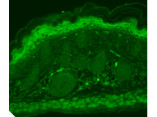 TrpV3 Antibody in Immunohistochemistry (Paraffin) (IHC (P))