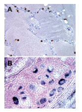BI1 Antibody in Immunohistochemistry (Paraffin) (IHC (P))