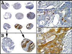 Caspase-1 Antibody in Immunohistochemistry (Paraffin) (IHC (P))