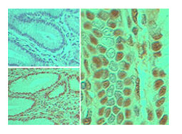 Caspase-8 Antibody in Immunohistochemistry (Paraffin) (IHC (P))