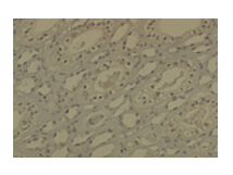 DNMT1 Antibody in Immunohistochemistry (Paraffin) (IHC (P))