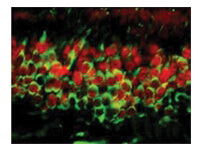 Dnmt3a Antibody in Immunocytochemistry (ICC/IF)