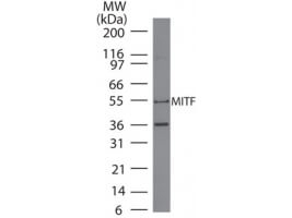 MITF Antibody in Western Blot (WB)