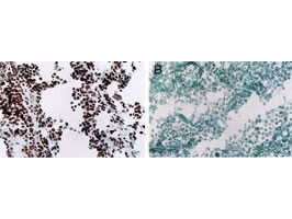 MyoD Antibody in Immunohistochemistry (Paraffin) (IHC (P))