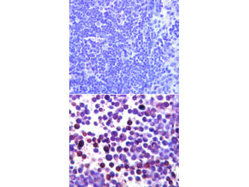 NOXA Antibody in Immunohistochemistry (Paraffin) (IHC (P))