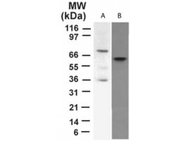 p73 Antibody in Western Blot (WB)