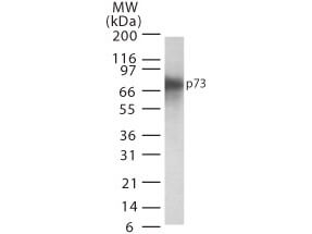 p73 Antibody in Western Blot (WB)