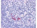 RANKL Antibody in Immunohistochemistry (Paraffin) (IHC (P))