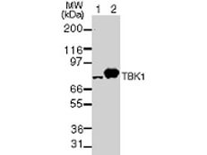 TBK1 Antibody in Western Blot (WB)