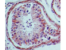 TLR4 Antibody in Immunohistochemistry (Paraffin) (IHC (P))