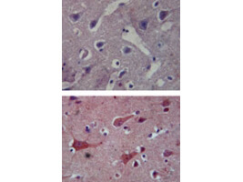 TLR8 Antibody in Immunohistochemistry (Paraffin) (IHC (P))