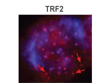 TRF2 Antibody in Immunocytochemistry (ICC/IF)