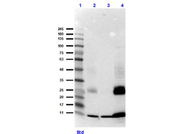 Hemoglobin Antibody in Western Blot (WB)