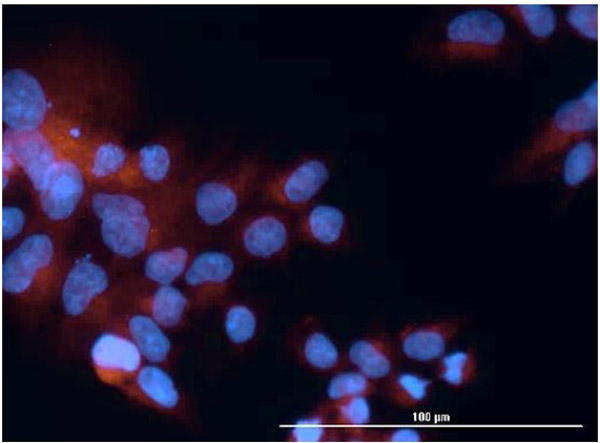 hFcRn Antibody in Immunocytochemistry (ICC/IF)
