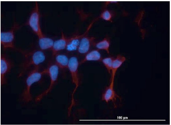 hFcRn Antibody in Immunocytochemistry (ICC/IF)
