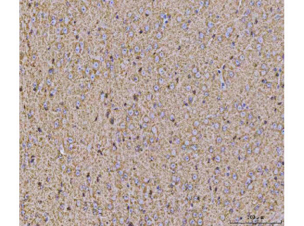 Calcineurin alpha Antibody in Immunohistochemistry (Paraffin) (IHC (P))