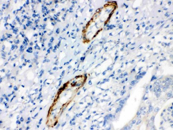 Caldesmon (smooth) Antibody in Immunohistochemistry (Paraffin) (IHC (P))