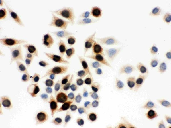Cyclin A Antibody in Immunocytochemistry (ICC/IF)