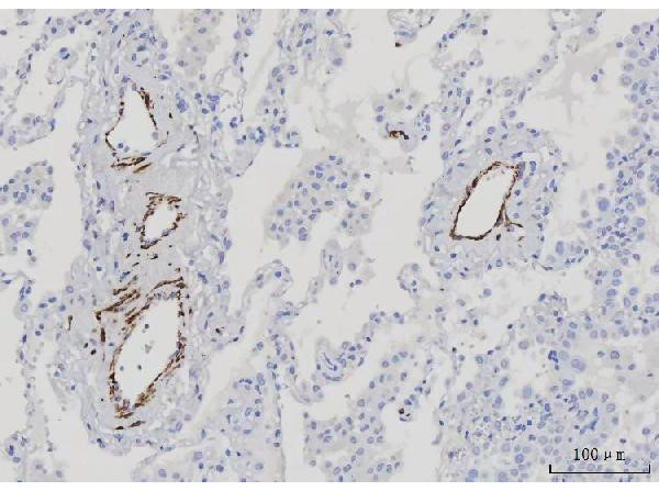 Desmin Antibody in Immunohistochemistry (Paraffin) (IHC (P))
