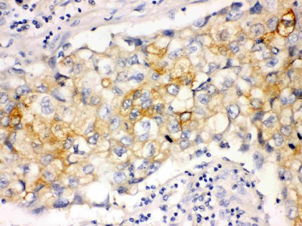 Involucrin Antibody in Immunohistochemistry (Paraffin) (IHC (P))