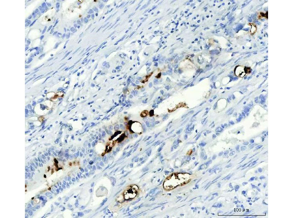 Mucin Gastric Antibody in Immunohistochemistry (Paraffin) (IHC (P))
