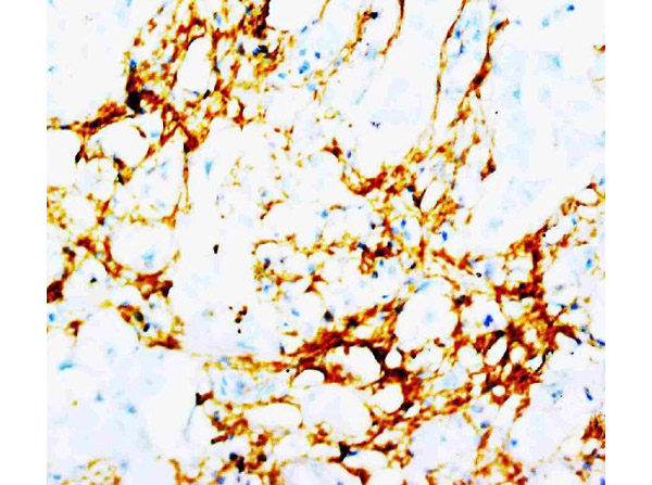 Tenascin Antibody in Immunohistochemistry (Paraffin) (IHC (P))