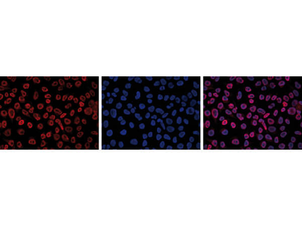 5-mC Antibody in Immunocytochemistry (ICC/IF)
