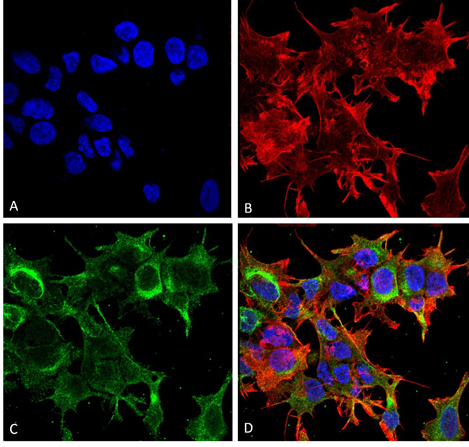 GFAP R416WT Antibody in Immunocytochemistry (ICC/IF)