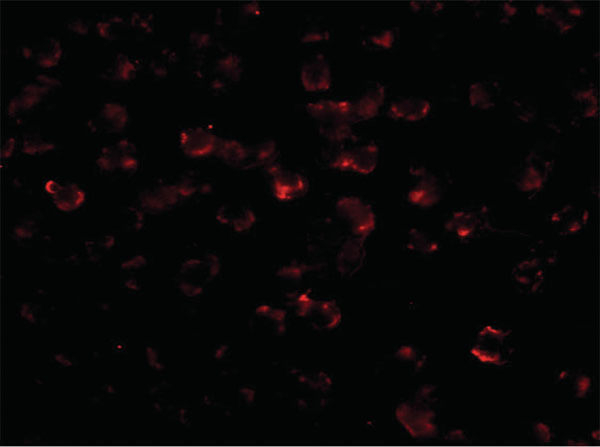 BIM Antibody in Immunocytochemistry (ICC/IF)