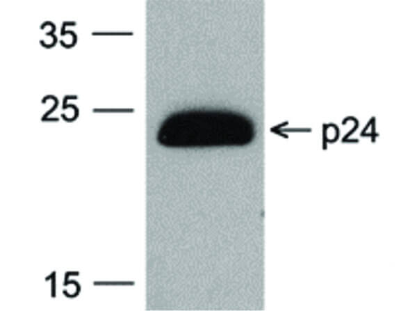 HIV-1 p24 Antibody in Western Blot (WB)