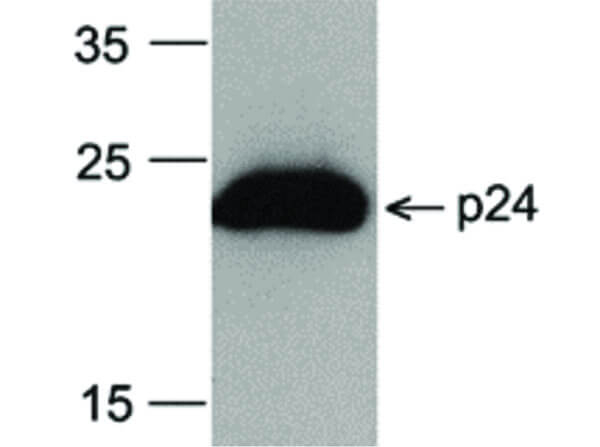 HIV-1 p24 Antibody in Western Blot (WB)