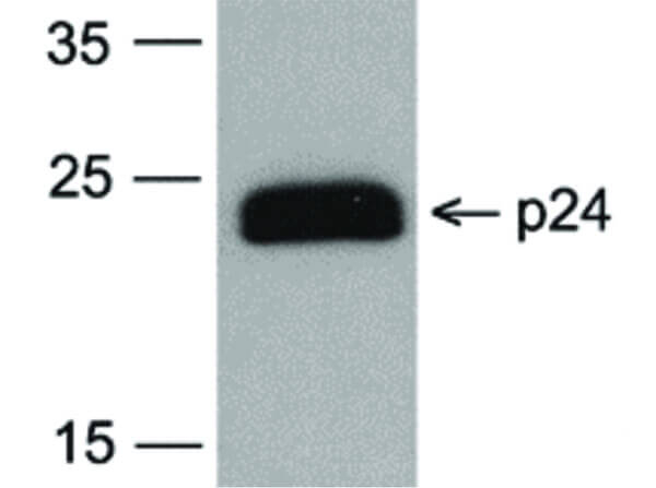 HIV-1 p24 Antibody in Western Blot (WB)