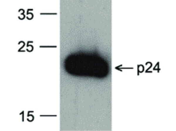 HIV-1 p24 Antibody in Western Blot (WB)