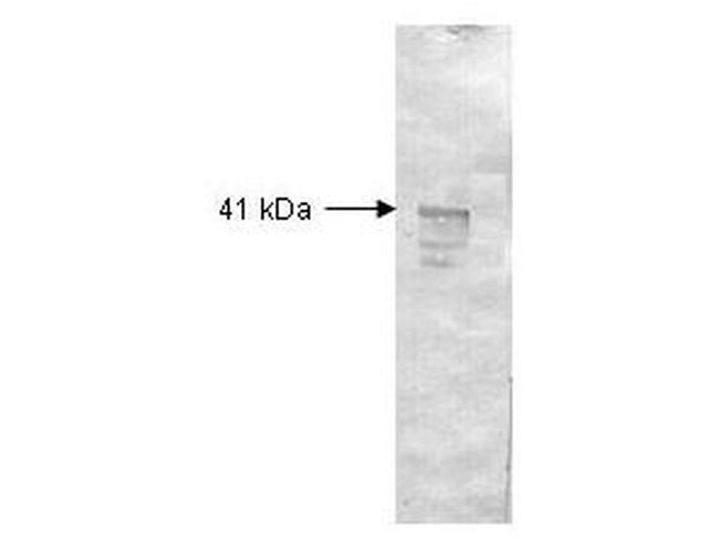 Dextranase Antibody in Western Blot (WB)