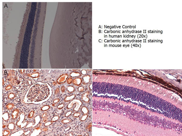 Carbonic Anhydrase II Antibody in Immunohistochemistry (Paraffin) (IHC (P))
