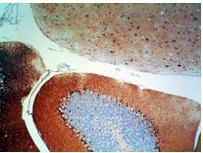 S100 Protein Antibody in Immunohistochemistry (Paraffin) (IHC (P))