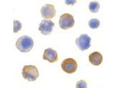 IRAK Antibody in Immunocytochemistry (ICC/IF)