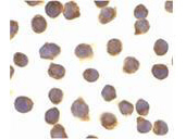 FLIP Alpha Antibody in Immunocytochemistry (ICC/IF)